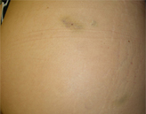 Patient # 58432 After Photo # 2